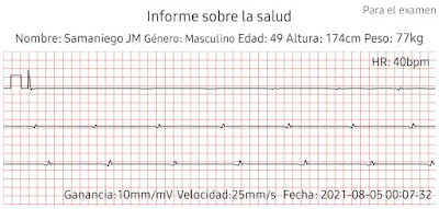 ECG Reloj Smartwatch Prixton SWB 210805 a 40 BPM