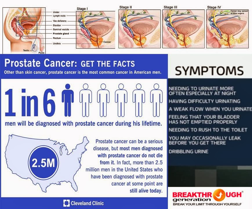 Does prostate cancer kill more than breast cancer
