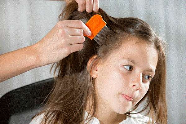 Home remedies for treating head lice home remedies