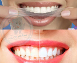 كيفية استخدام بقع كريست خطوة بخطوة