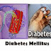 Obat Penyakit Kencing Manis, Cara Ampuh Menyembuhkan Penderita Diabetes Melitus Secara Alami Dan Tanpa Efek Samping