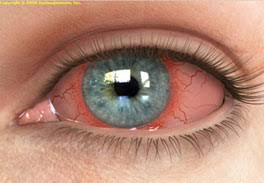diabetes and eye care