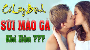 hôn có bị lây sùi mào gà không