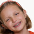 Khắc phục tình trạng răng mọc lệch cho trẻ