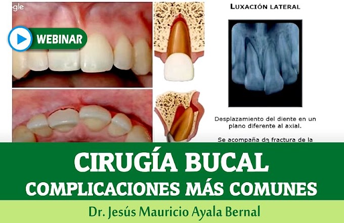 WEBINAR: Complicaciones en Cirugía Bucal - Dr. Jesús Mauricio Ayala Bernal