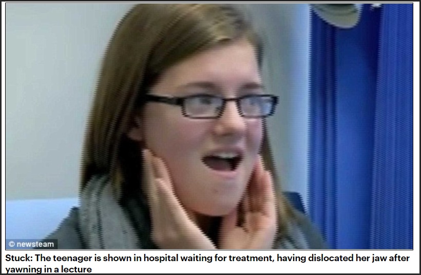 Student Dislocates Jaw While Yawning So Hard During Lecture PinoyNewz