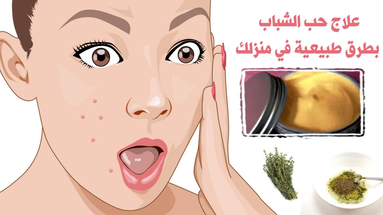 كيفية علاج حب الشباب - 4 أسرار للتخلص من حب الشباب بشكل طبيعي 4 Secrets to Get Rid of Acne كيفية علاج حب الشباب - 4 أسرار للتخلص من حب الشباب بشكل طبيعي 4 Secrets to Get Rid of Acne