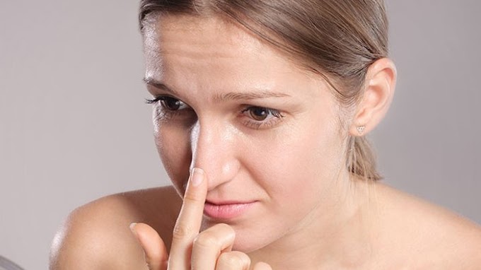 5 Langkah Hilangkan Komedo Lewat Cara Alami Dengan Aman