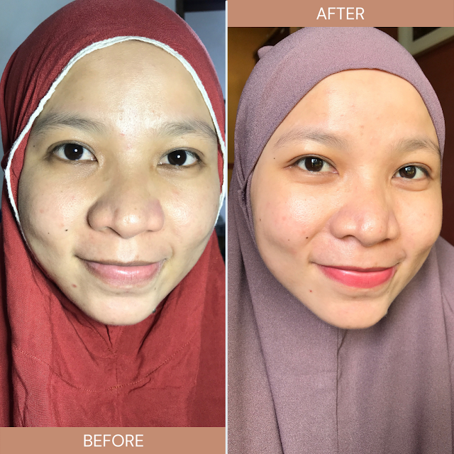 review serum bakuchiol, review serum bakuchiol indoganic, hasil pemakaian serum indoganic, serum bakuchiol untuk jerawat, serum bakuchiol untuk noda bekas jerawat, serum bakuchiol untuk kulit sensitif, serum bakuchiol