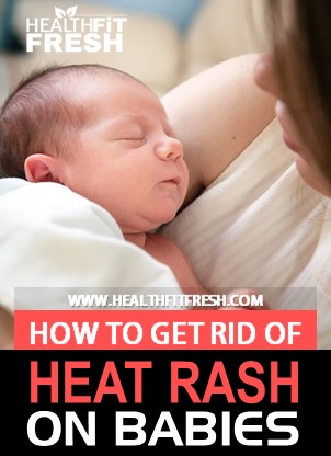 How To Get Rid Of Heat Rash On Babies, heat rash home remedies, get rid of heat rash fast