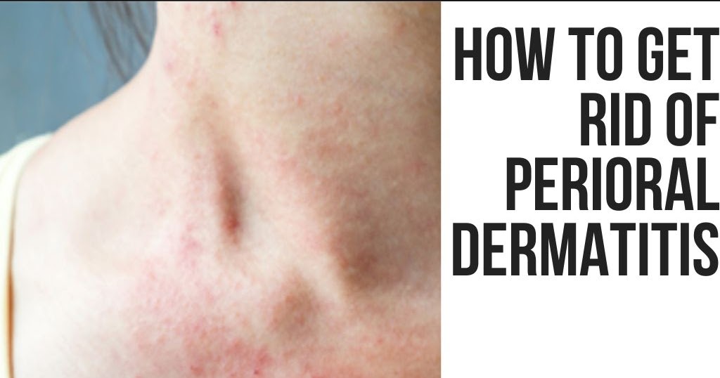 blume meltdown cystic acne blume meltdown cystic acne