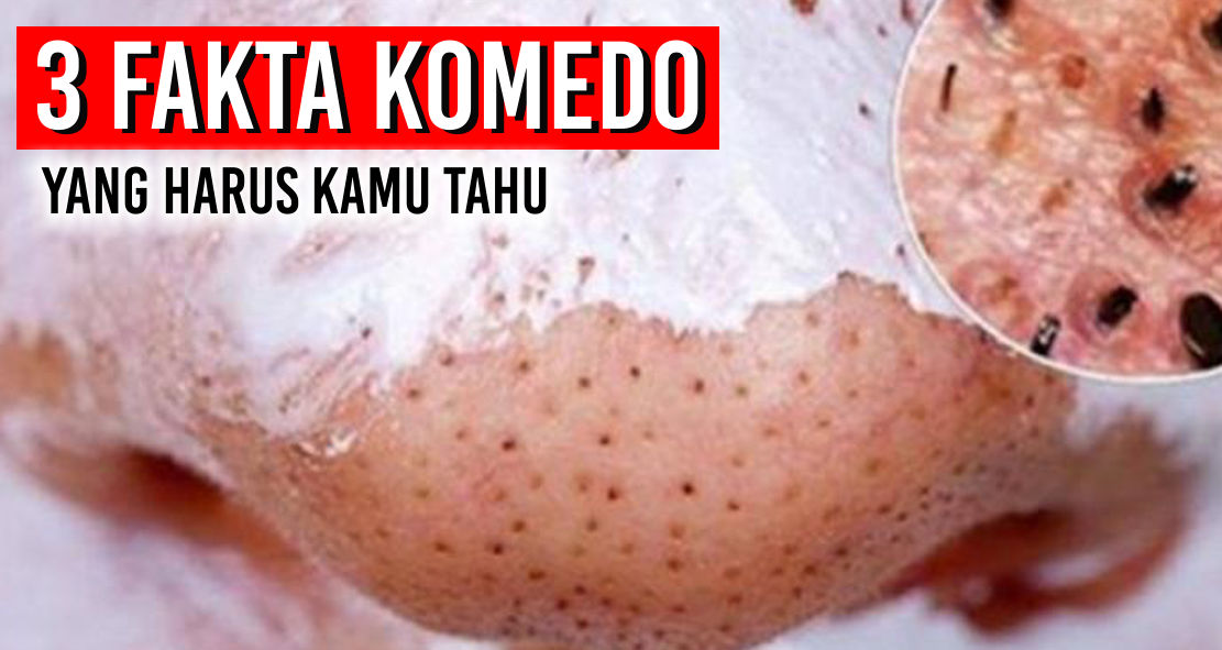 3 fakta komedo yang harus kamu ketahui zeropromosi souvenir barang