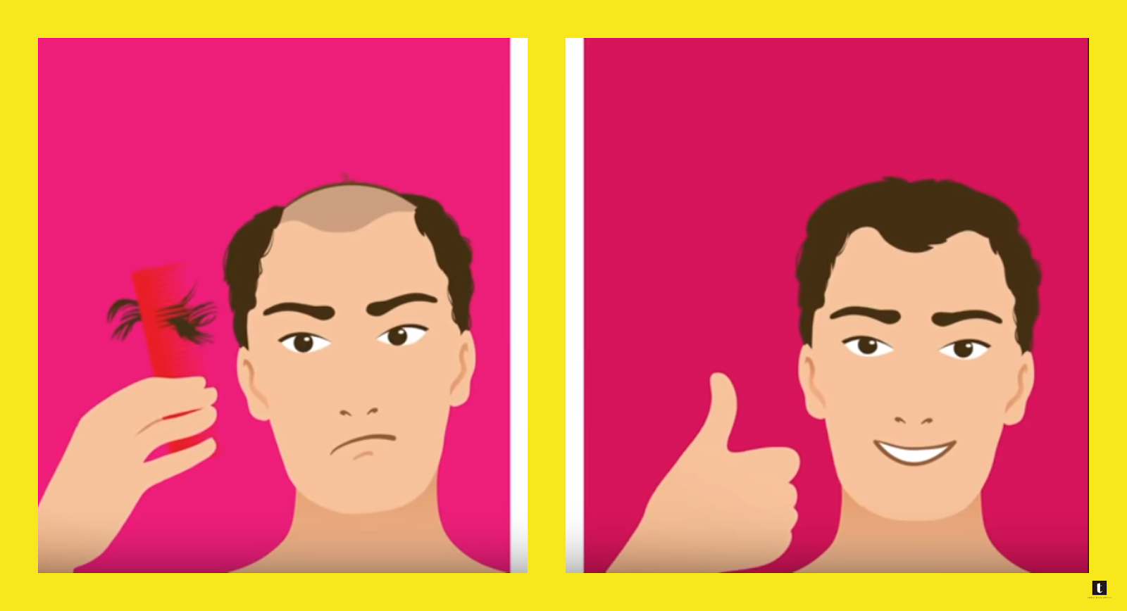 Have you lost hope? Here are the last solutions to get your hair back Have you lost hope? Here are the last solutions to get your hair back