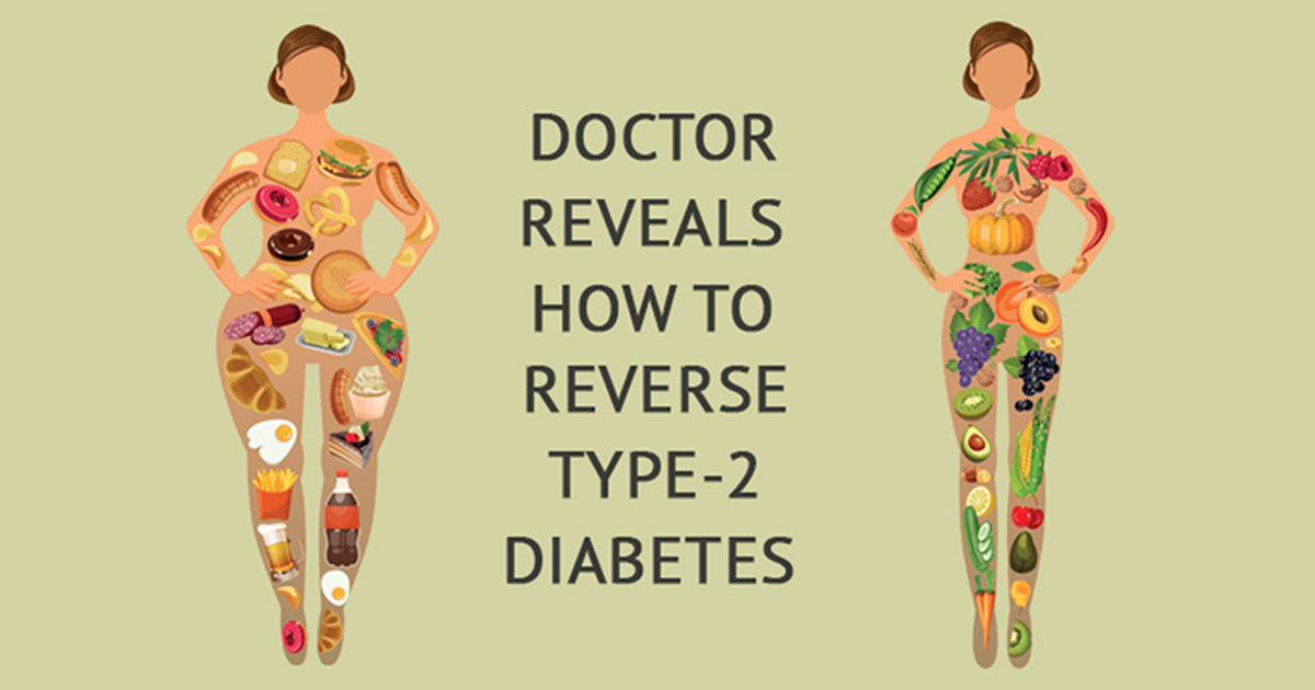 How To Reverse Type 2 Diabetes Naturally
