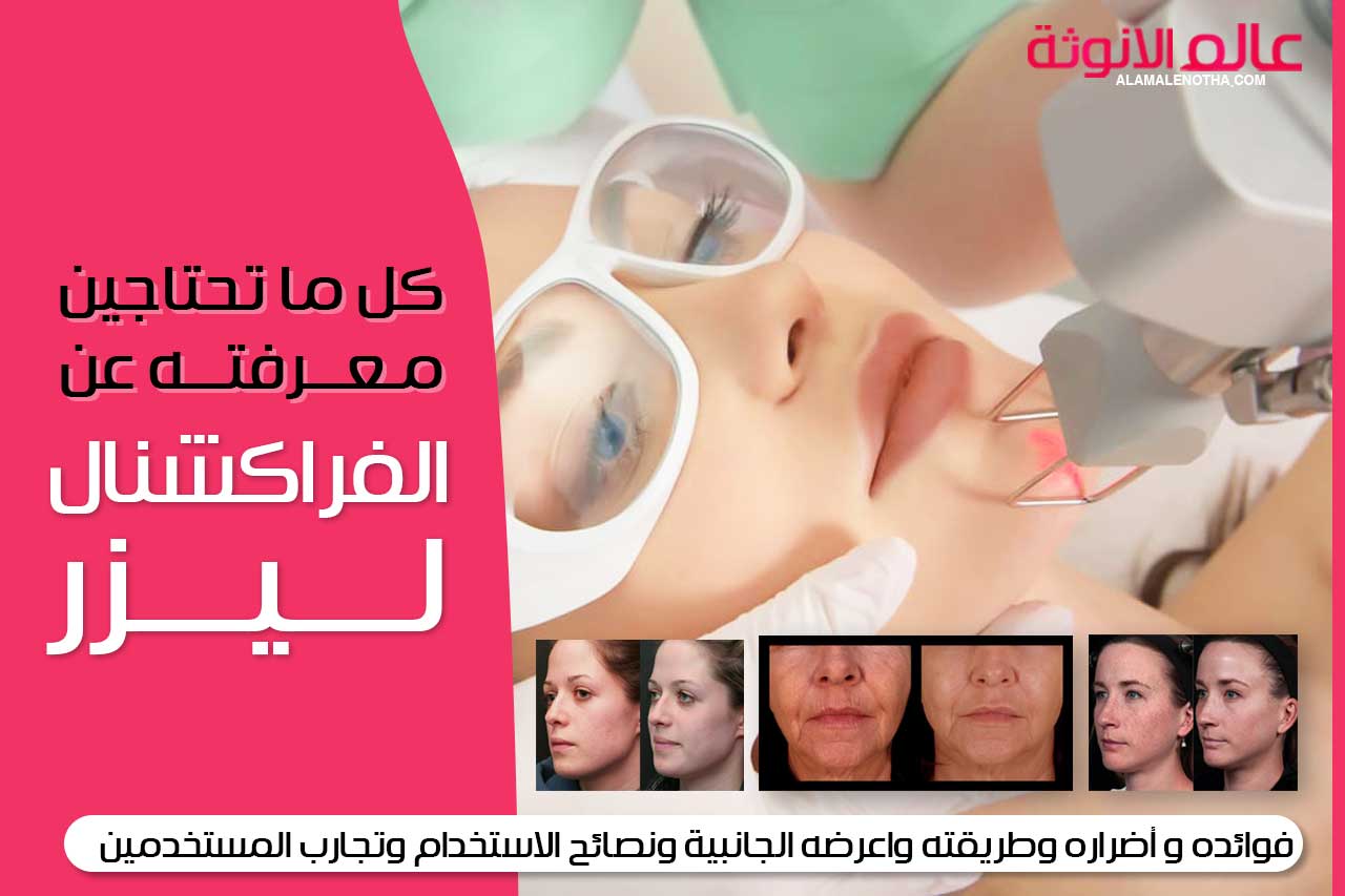 الفراكشنال ليزر هو كل ما تحتاج لمعرفته حول الفراكشنال ليزر قبل استخدامه