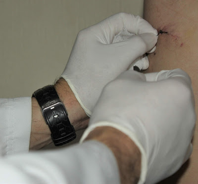 IMSS Sonora innova en cirugías sin anestesia general 