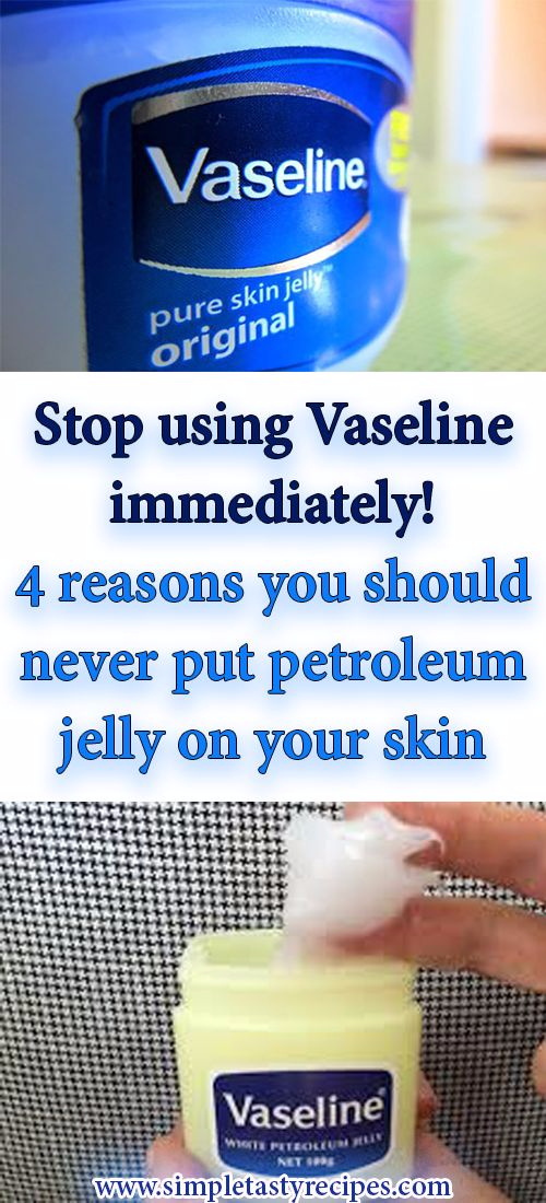 Stop using Vaseline immediately! 4 reasons you should never put