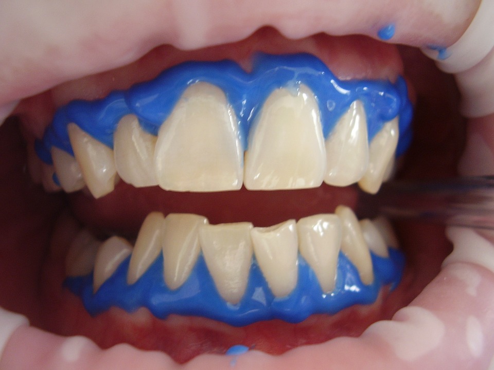 Buenas razones para la odontología estética