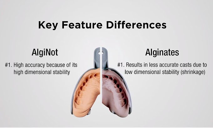 DENTAL IMPRESSION: Making a Temporary Crown with Alginate Alternative