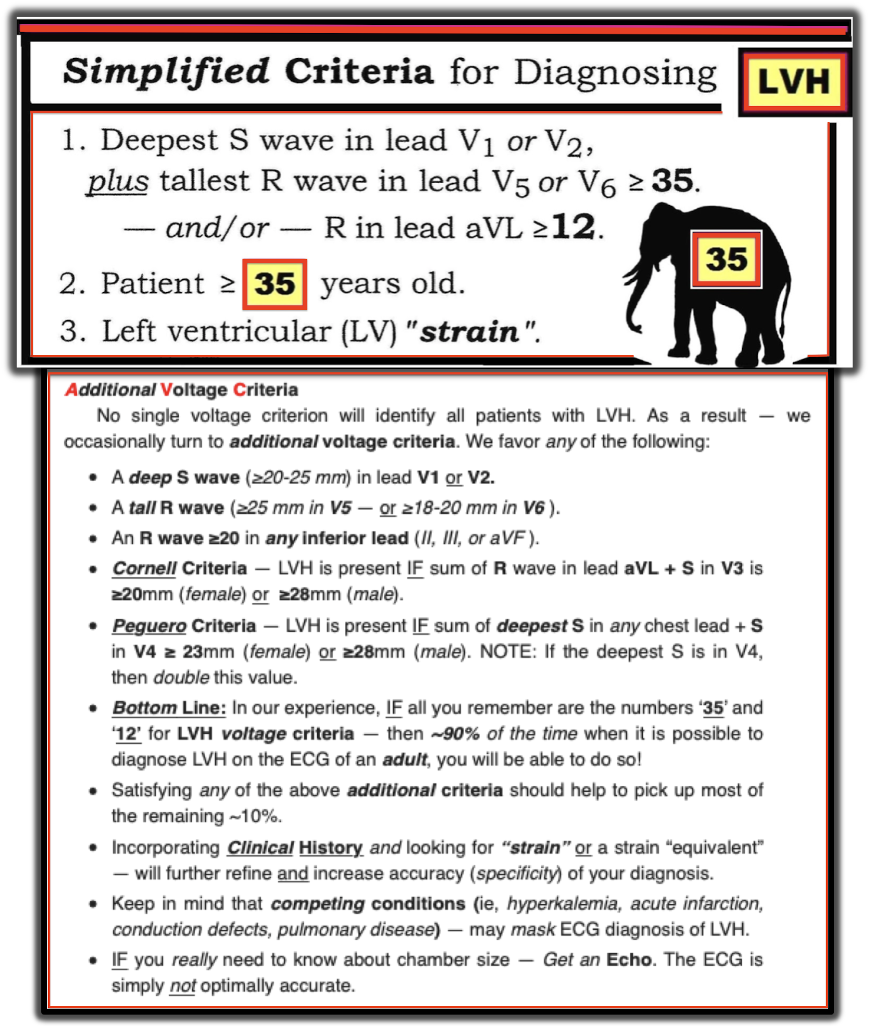 ECG Interpretation ECG Blog 205 — What is Trifascicular Block?