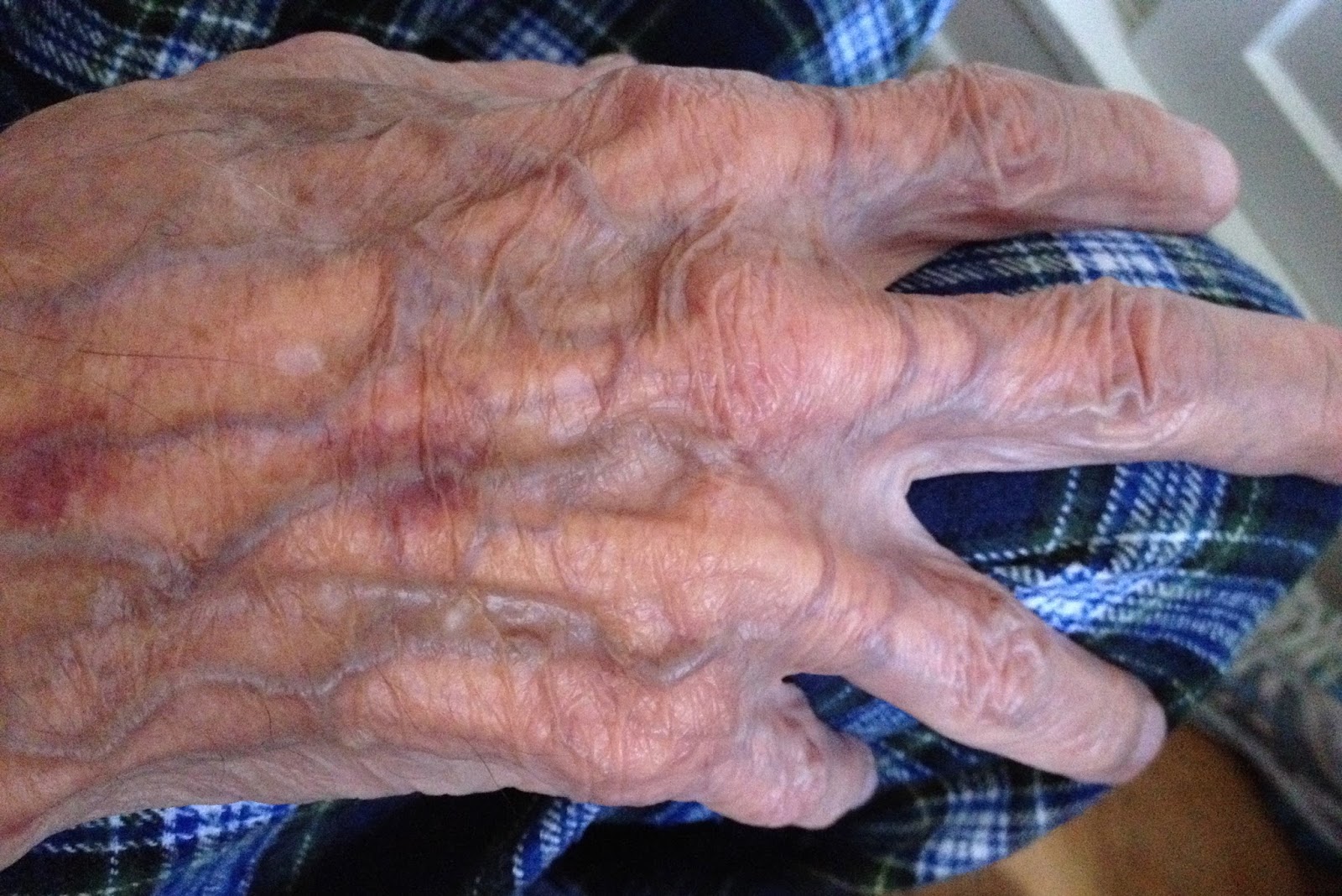 Cultivating Joy FRAGILE SENIOR SKIN