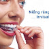 Ưu điểm của niềng răng Invisalign