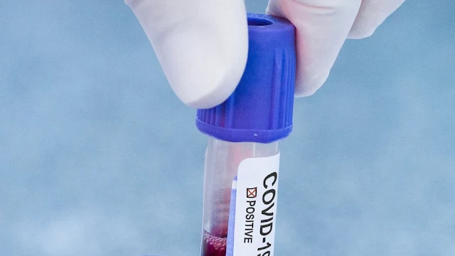 المهدية : تسجيل 55 إصابة جديدة بفيروس كورونا