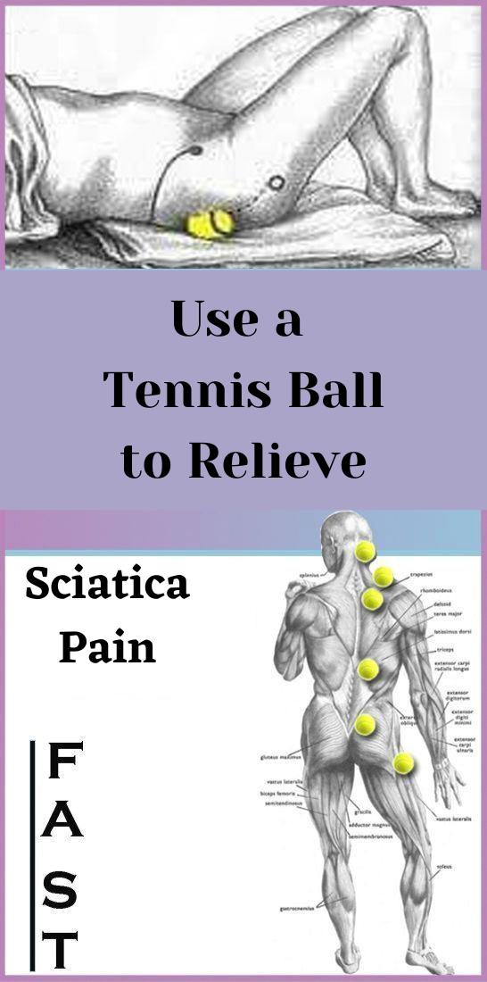 Use a Tennis Ball to Relieve Sciatica Pain Fast wellness topic