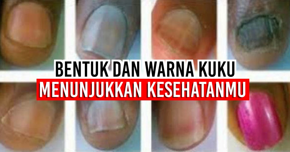Ternyata Bentuk Dan Warna Kuku Menunjukkan Kesehatanmu Barang Promosi Mug Promosi Payung Promosi Pulpen Promosi Jam Promosi Topi Promosi Tali Nametag