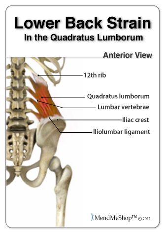 diagram of lower back in the quadratus lumborum diagram of lower back in the quadratus lumborum