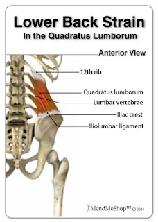 Pain in the Quadratus Lumborum Muscle