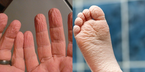 Why do your palms and feet get wrinkly when immersed in water?  