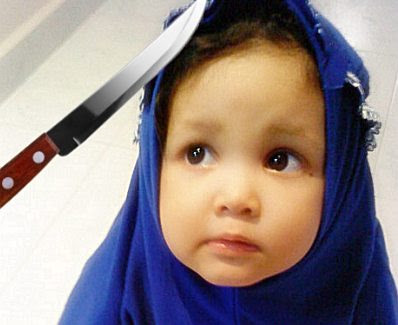 FGM: 'patient' and knife