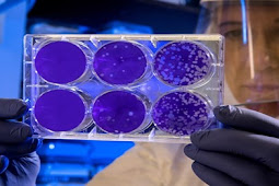 تسجيل اول حالة اصابة بفيروس كورونا بالمغرب لدى مهاجر قادم من ايطاليا