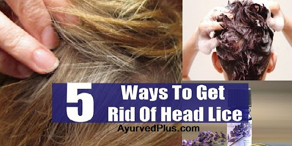 5 Ways To Get Rid Of Head Lice