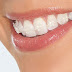 Niềng răng sứ giá bao nhiêu cho một hàm ?