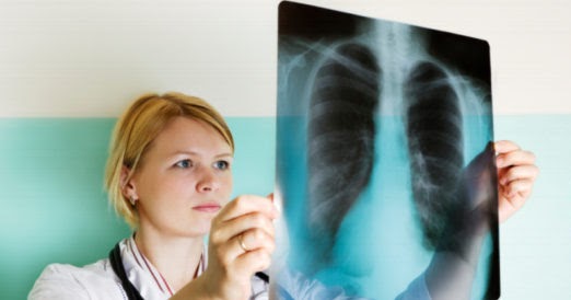 What is Mesothelioma Cancer? Symptoms,Causes,Treatment,Life expectancy..  Mesothelioma Guide