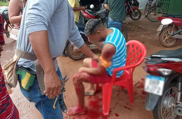 Vítima é baleada durante tentativa de roubo em Guajará-Mirim – IMAGENS FORTES 4 Vítima é baleada durante tentativa de roubo em Guajará-Mirim – IMAGENS FORTES