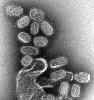 Grip virüsü, yaklaşık 100.000 kez büyütüldü