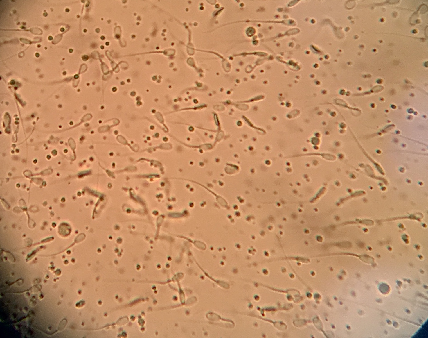 OBSERVACIÓN Y RECUENTO DE ESPERMATOZOIDES DE CONEJO