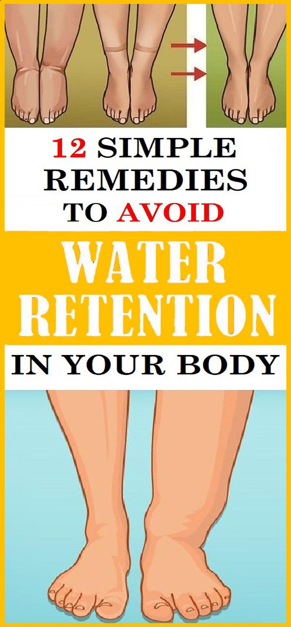 12 SIMPLE REMEDIES TO AVOID WATER RETENTION IN YOUR BODY Health and Tips