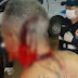 Após dizer que não tinha medo de facção, homem é atacado com golpes de facão