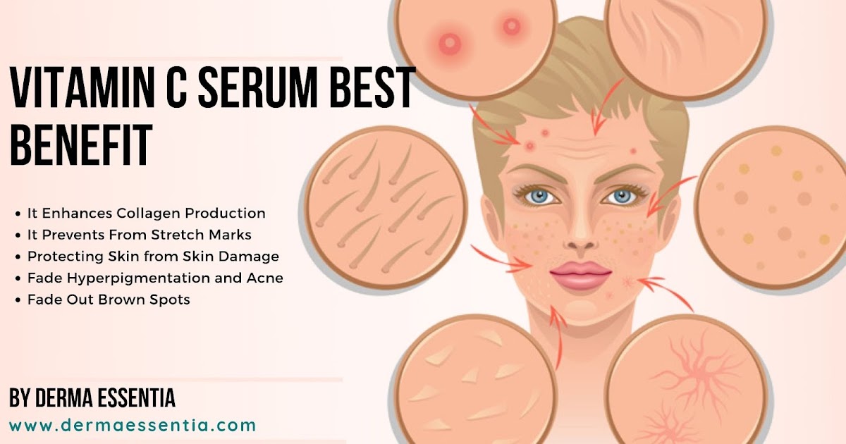 Why Should I Use Vitamin C Serum?