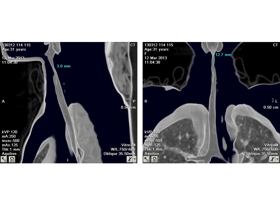 VIETNAMESE MEDIC ULTRASOUND CASE 193 MEDIC RADIOLOGY CASE 07