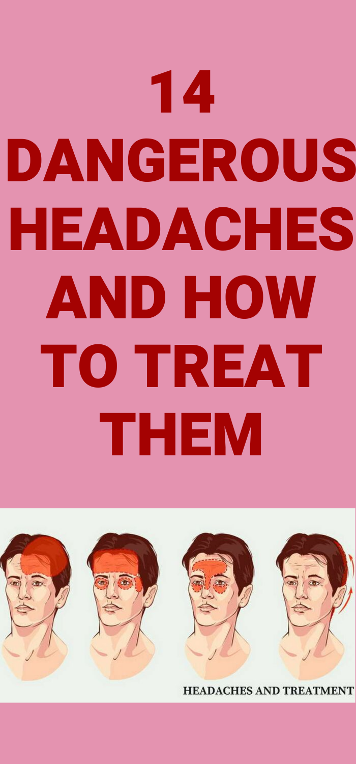 14 Dangerous Headaches And How to Treat Them