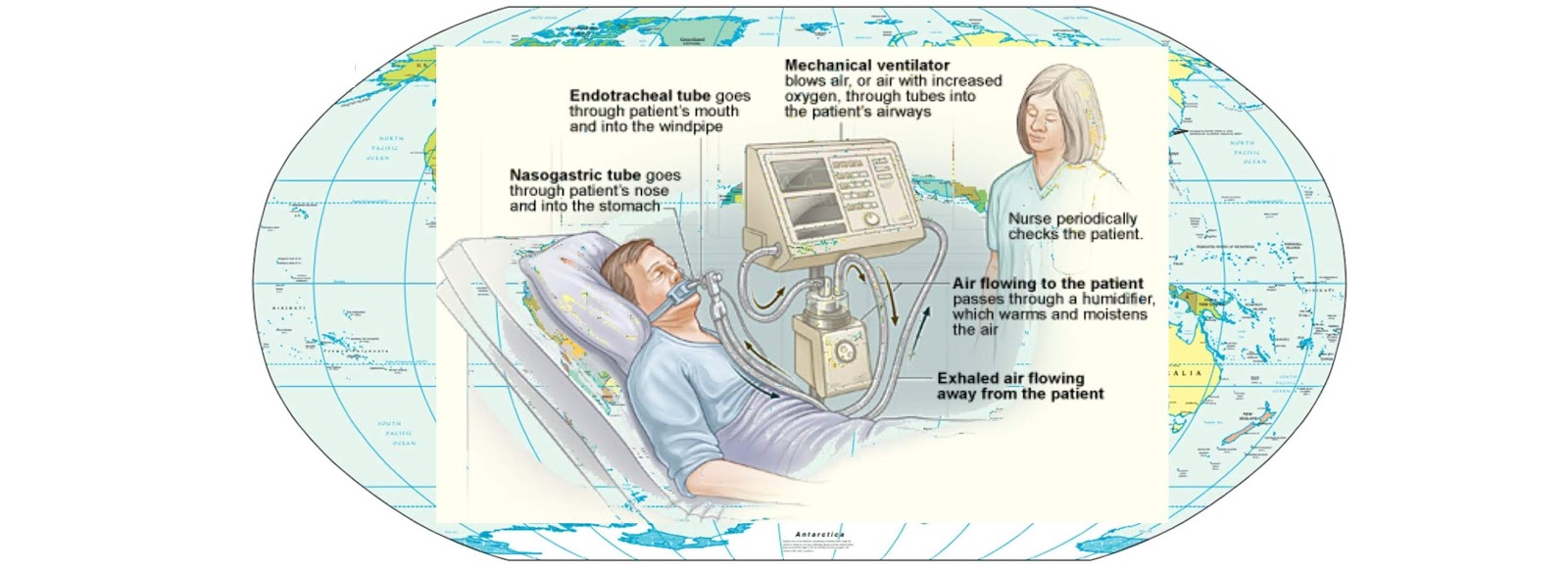 What is ventilators ! How do ventilators work to defeat Corona Virus