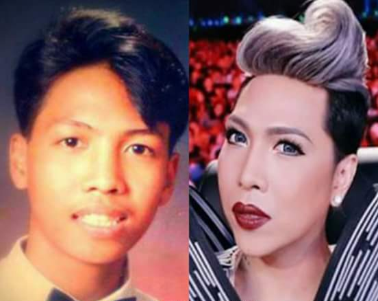 Before and After Photos of 10 Pinoy Celebrities Unrecognizable After Fame. Check Here and Be Amaze!