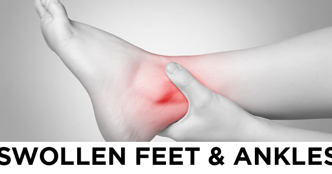 腫れ ぼっ たい 目 解消 ウォーキング