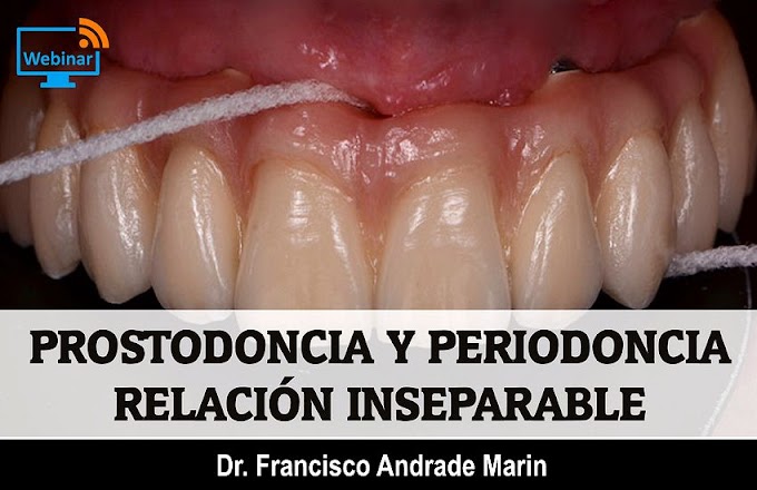 WEBINAR: Relación entre Prostodoncia y Periodoncia - Dr. Francisco Andrade Marin 