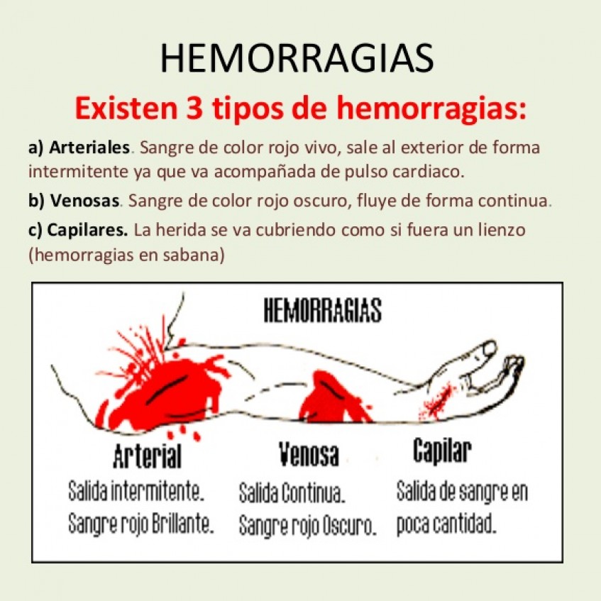 Blog Hemorragias Y Heridas Imagenes De Hemorragia | Sexiz Pix